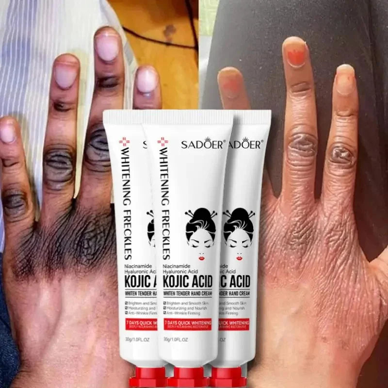 SADOER Kojic Acid Hand Cream MoisturizingAnti-chappingNourishingBrighteningHydrating Hand Creams Beauty Hands Skin Care Products - Surpriseshopper.com